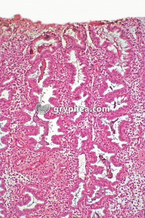 Endomètre sécrétoire x15 - gryphea.com